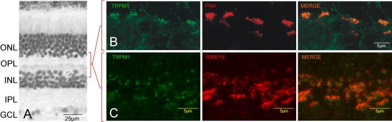 Harnessing TRMP1 for Potential Therapeutic Benefits