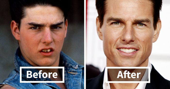 Showcasing Before and After Images for Maximum⁣ Impact